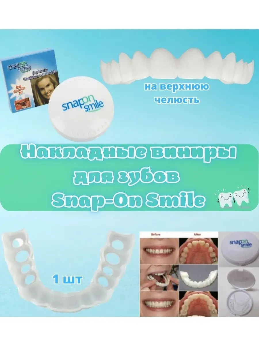 Накладные виниры для зубов Snap-On Smile GOODSTORAGE 117958735 купить в  интернет-магазине Wildberries