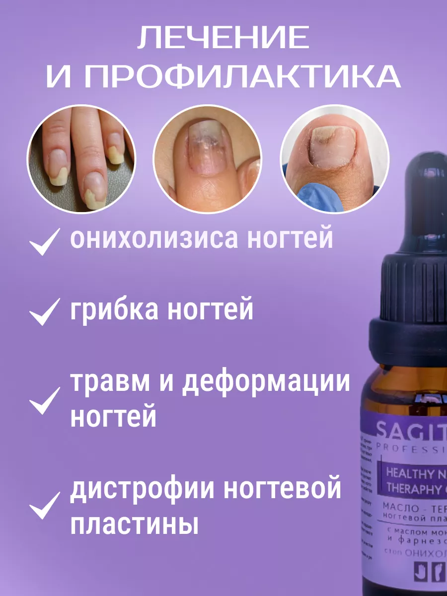 Против онихолизиса. Средство от онихолизиса ногтей. Капли от онихолизиса ногтей. Аптечное средство от онихолизиса ногтей.