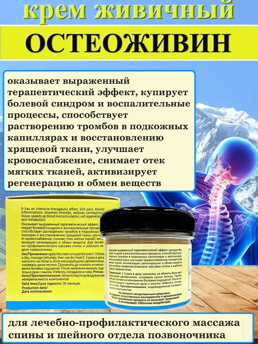 Остеохондроз