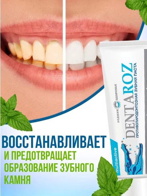 Родник Здоровья Зубная паста Dentaroz против пародонтоза мятная, вариант, фото 4